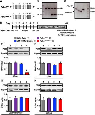 Cardiac-Specific Deletion of Pyruvate Dehydrogenase Impairs Glucose Oxidation Rates and Induces Diastolic Dysfunction